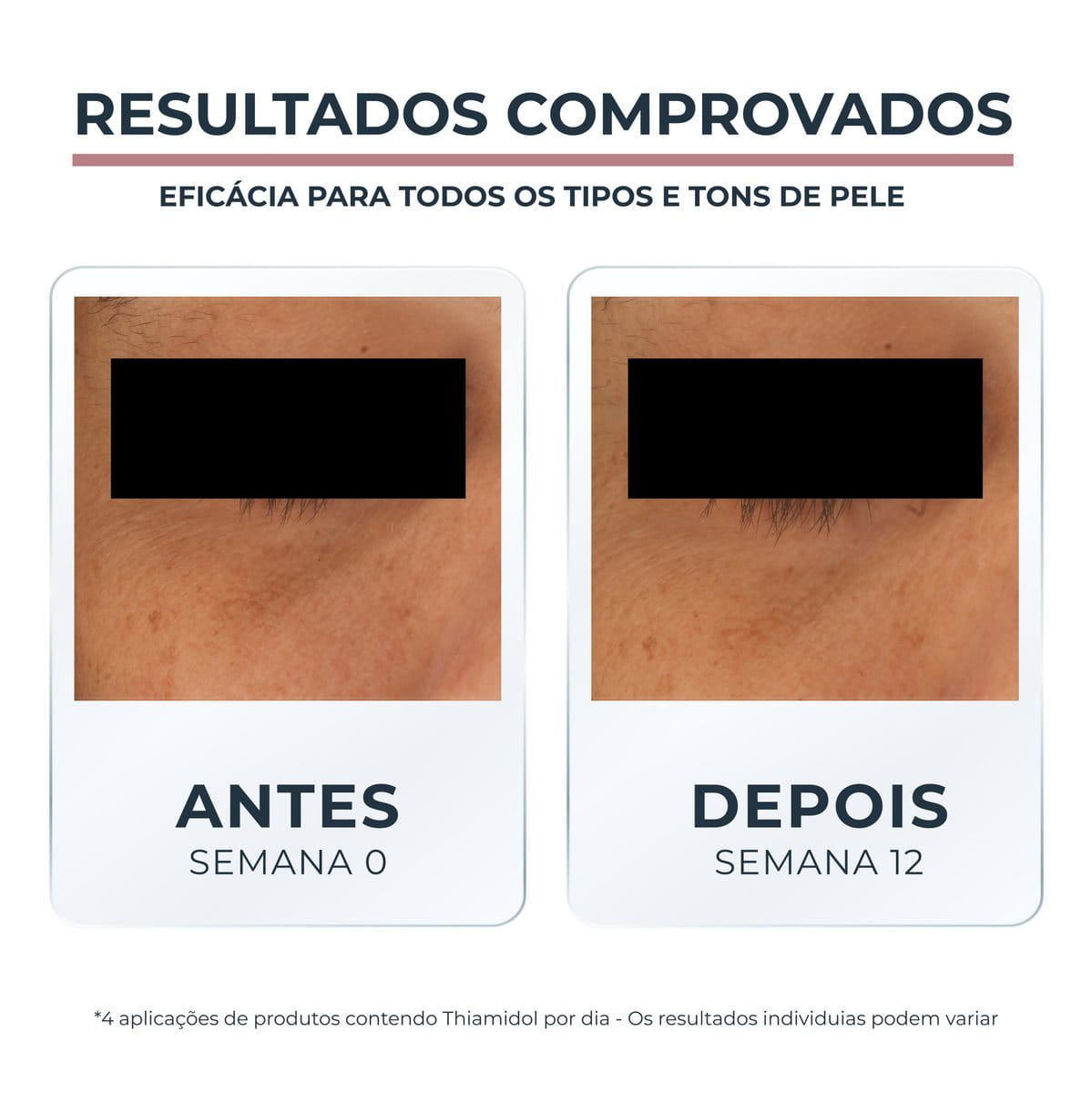 Eucerin Anti-Pigment Creme Clareador de Olheiras com Thiamidol 15ml